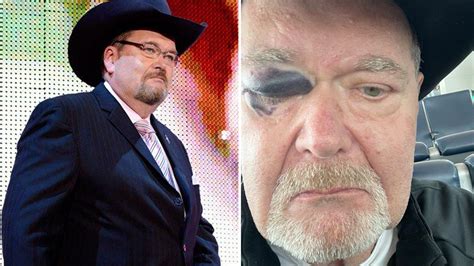 Jim Ross Discusses Whether WWE Wrestlers Were Forced To。